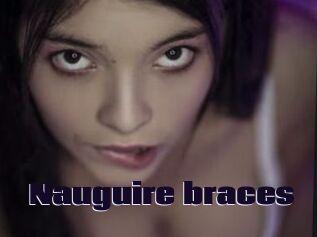 Nauguire_braces